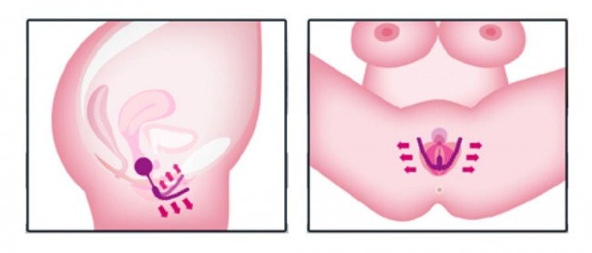 Тренажер интимных мышц Intimate Spreader Pussy Gym Тренажер интимных мышц Intimate Spreader Pussy Gym